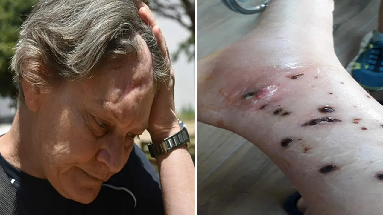 Eğitim Almadan Köpek Bakımında Çalışan Kadın Saldırıya Uğradı: Şirket Sahibinden Hesap Soruyor**